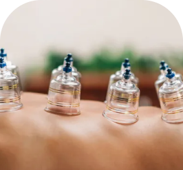 Hijama